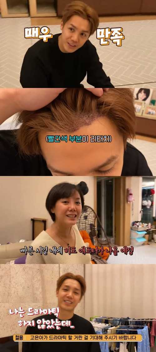 Bangane video stills of Mir discussing additional hair transplantation